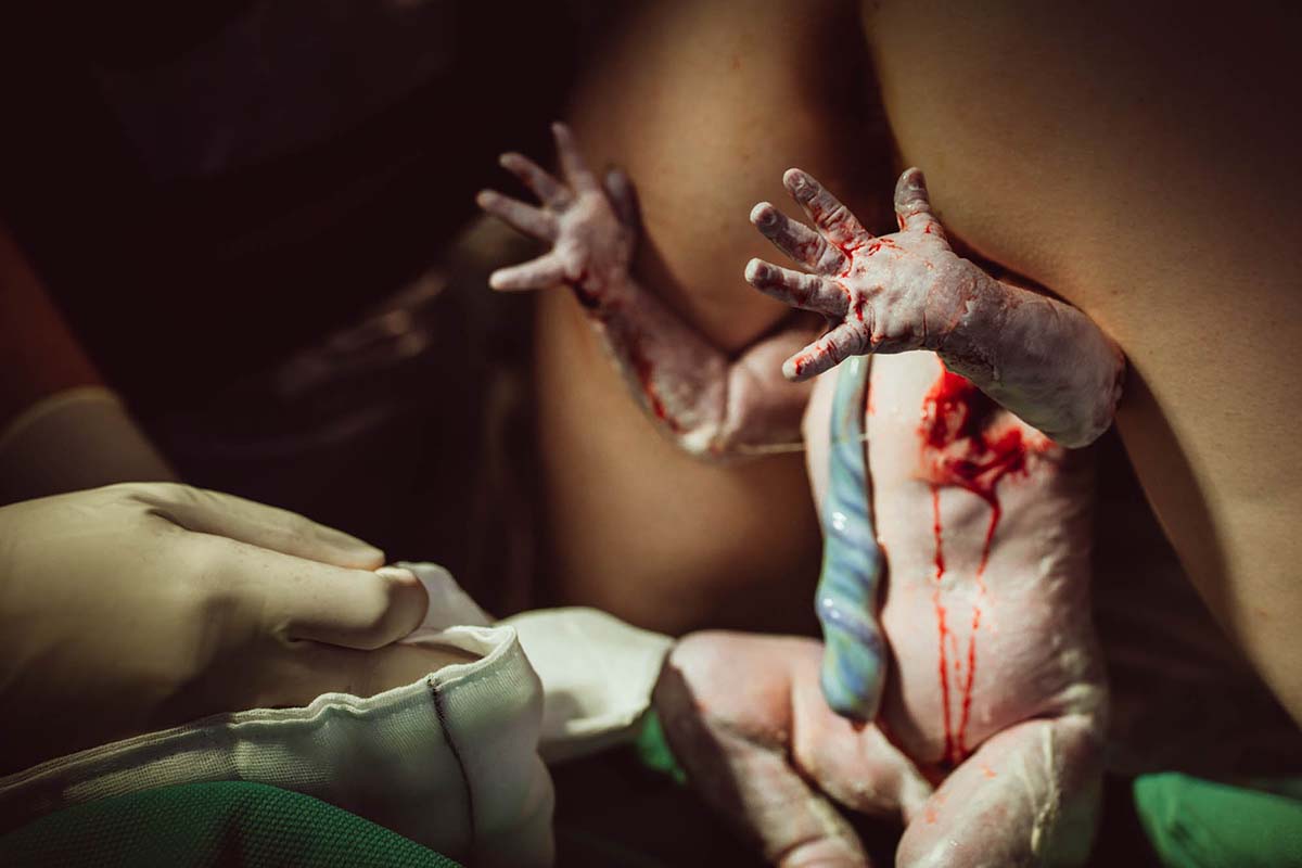 Εγκυμοσύνη & Μητρότητα | 8 δυνατές, βραβευμένες φωτογραφίες τοκετού που πρέπει να δείτε!